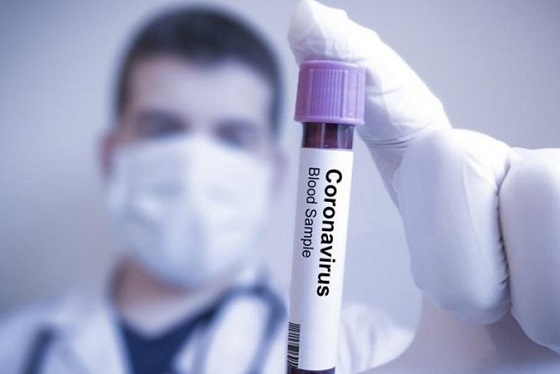 Koronavirüs testi hangi hastanelerde yapılıyor? 2
