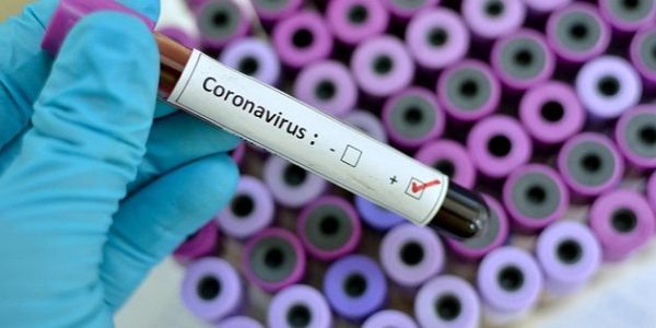 Koronavirüs testi hangi hastanelerde yapılıyor?