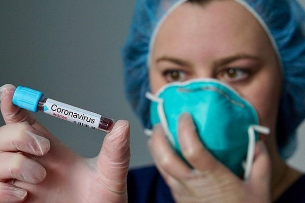 Koronavirüs testinde kriterler değişiyor